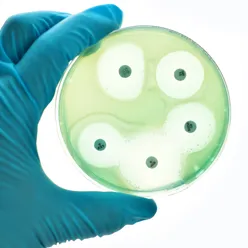 En hanskekledt hånd som holder en bakterieskål