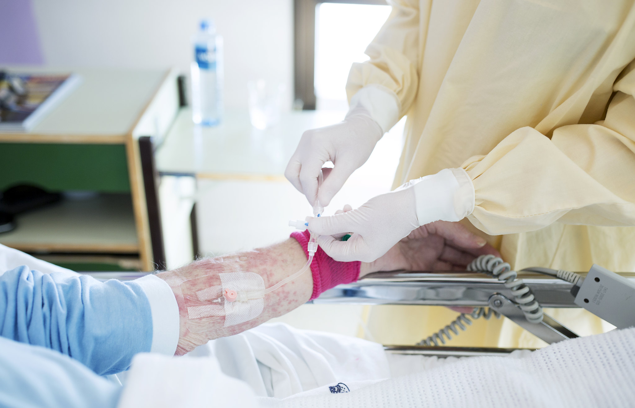 En pasient med hudreaksjon, som mottar iv behandling