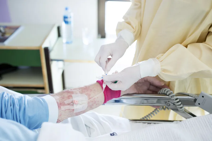 En pasient med hudreaksjon, som mottar iv behandling